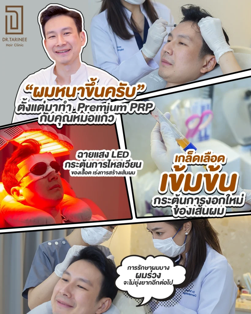 PRP ผมที่ไหนดี
