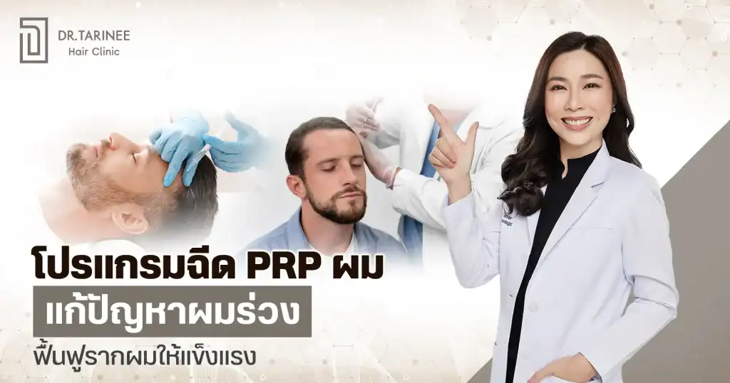 ฉีด PRP ผม