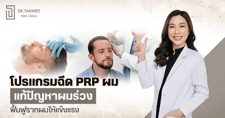 โปรแกรมฉีด PRP ผม แก้ปัญหาผมร่วง ฟื้นฟูรากผมให้แข็งแรง