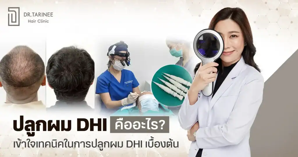 ปลูกผม DHI