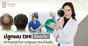 ปลูกผม DHI