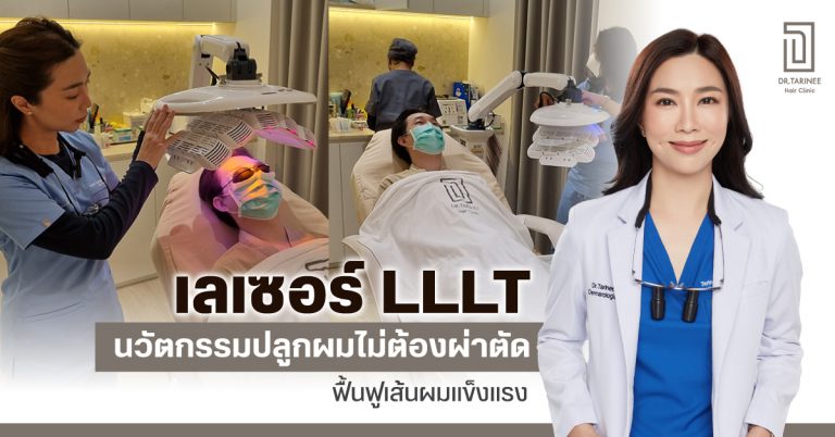 ปลูกผมด้วยเลเซอร์ LLLT ช่วยแก้ไขปัญหาผมบาง ทางออกของคนผมร่วง