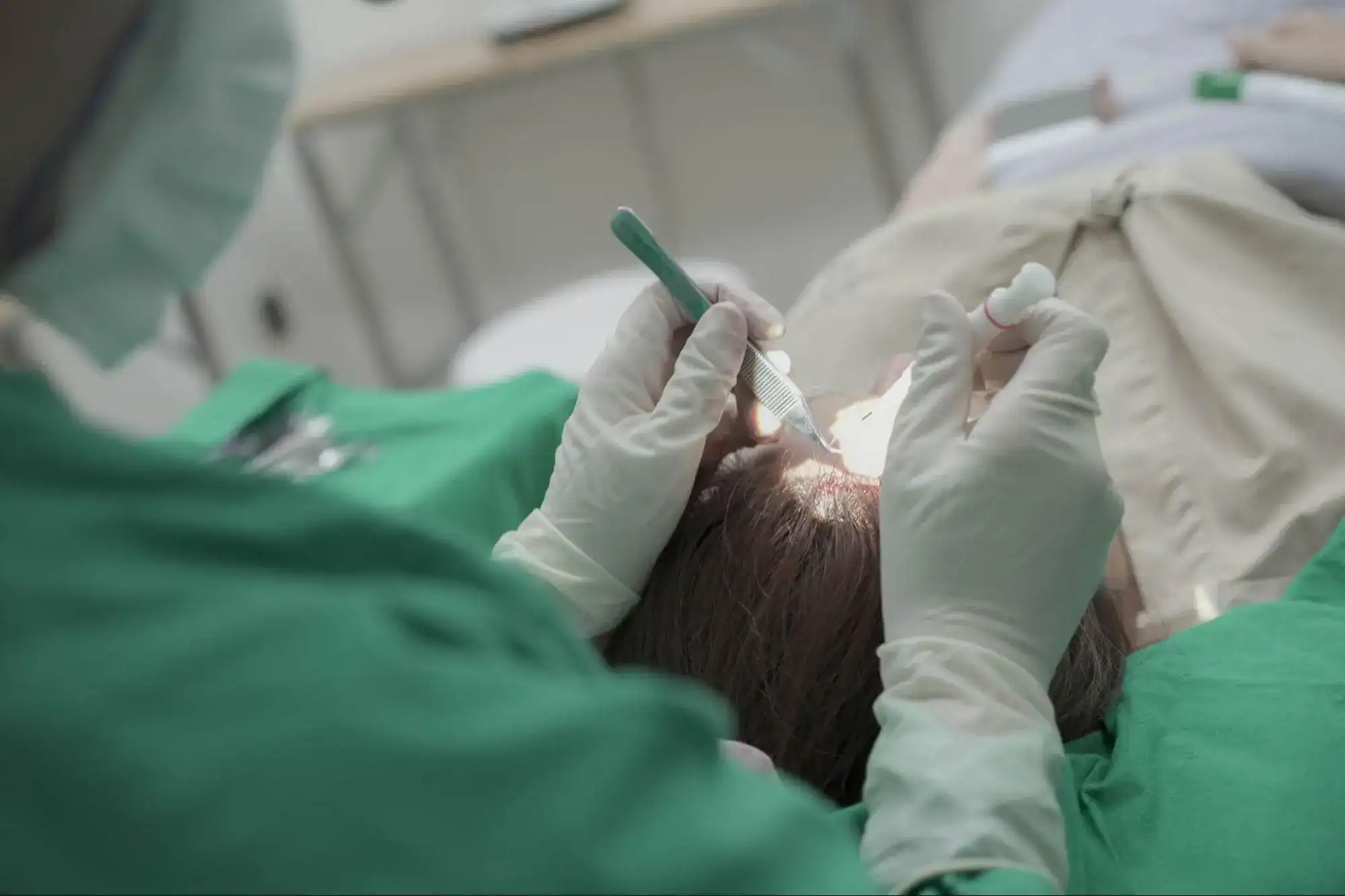 ปลูกผม DHI คือ