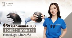 รีวิวปลูกผม