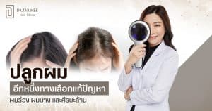 ปลูกผม