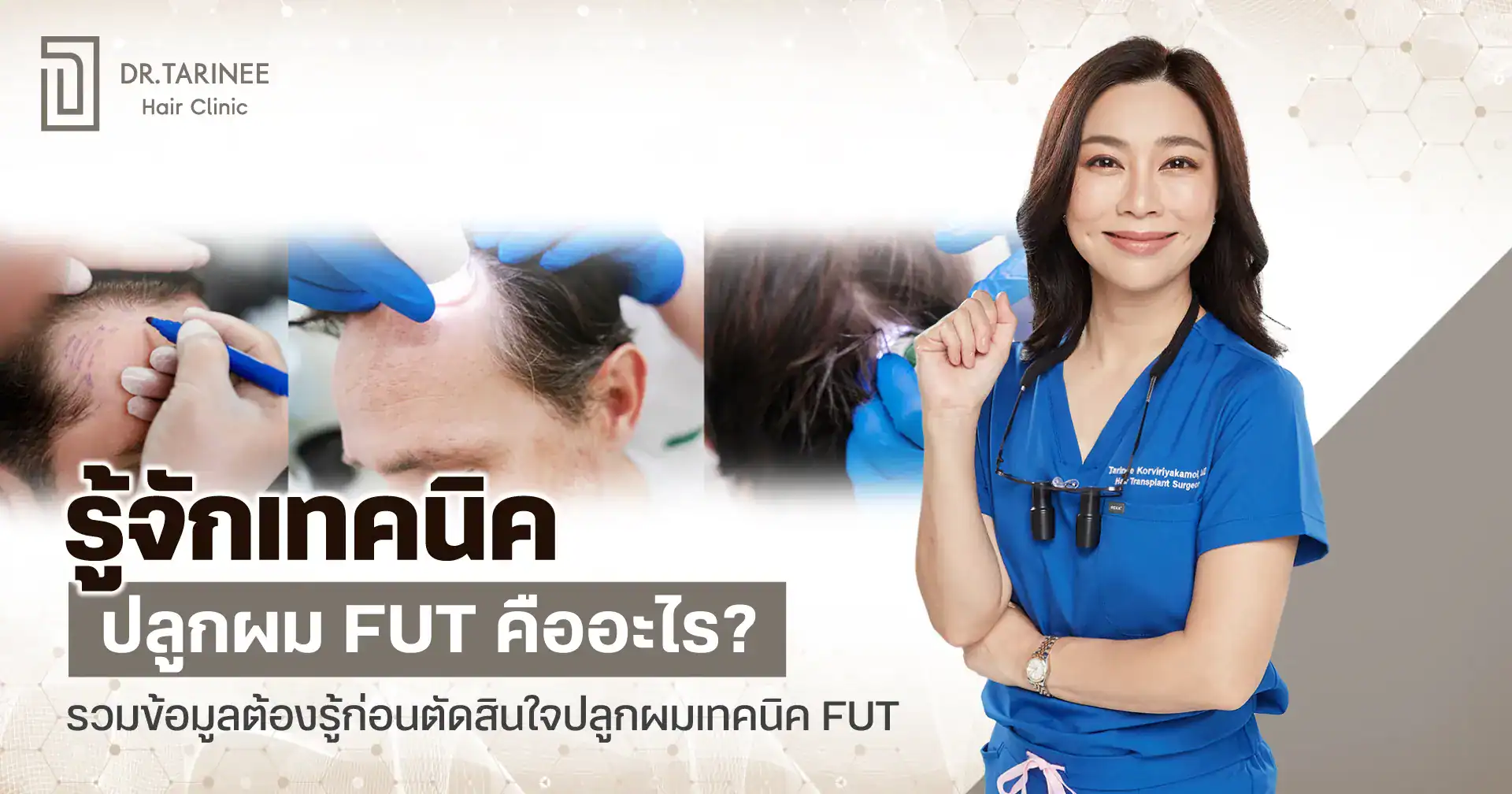 ปลูกผม FUT