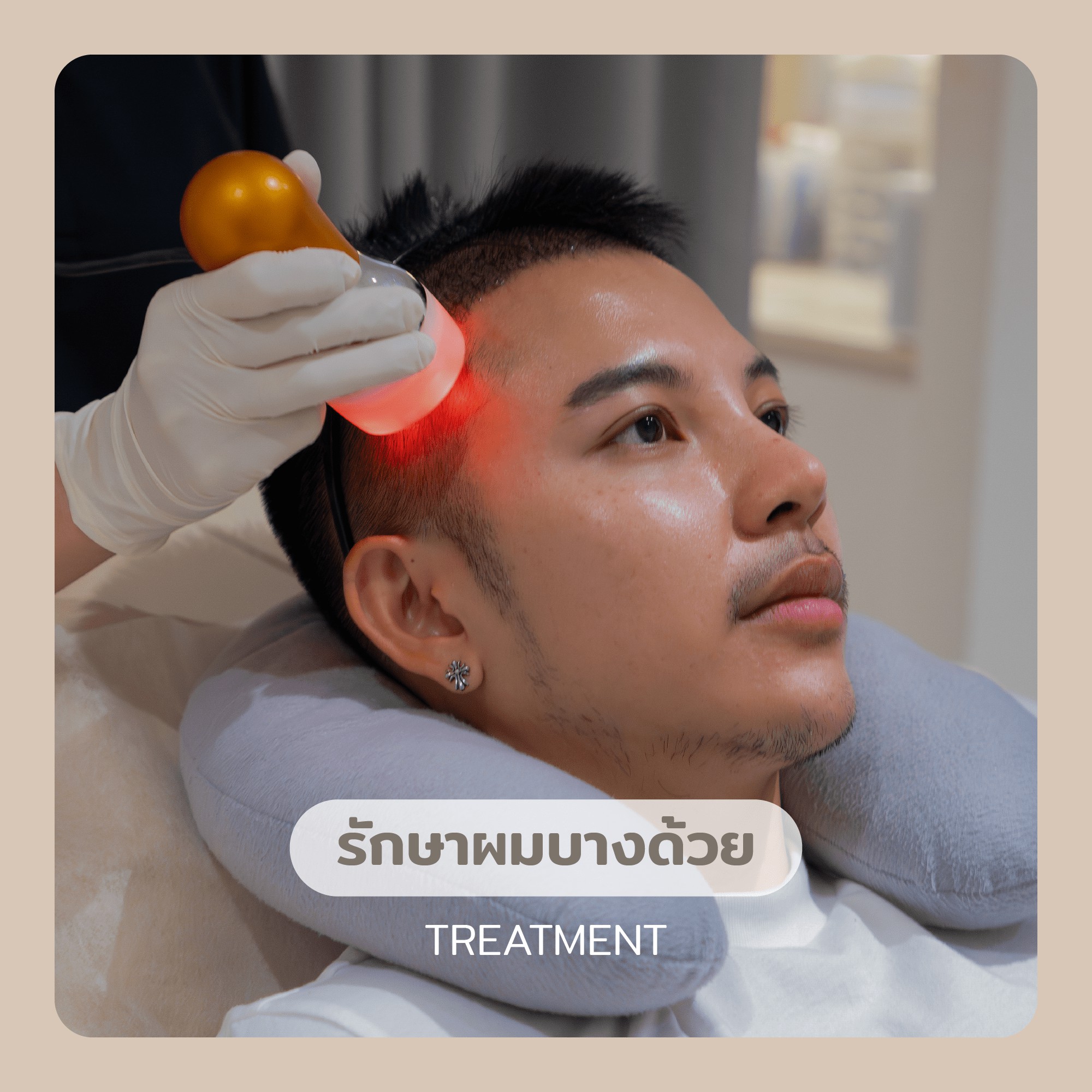 รักษาผมร่วง ผมบาง ด้วย Treatment Programs