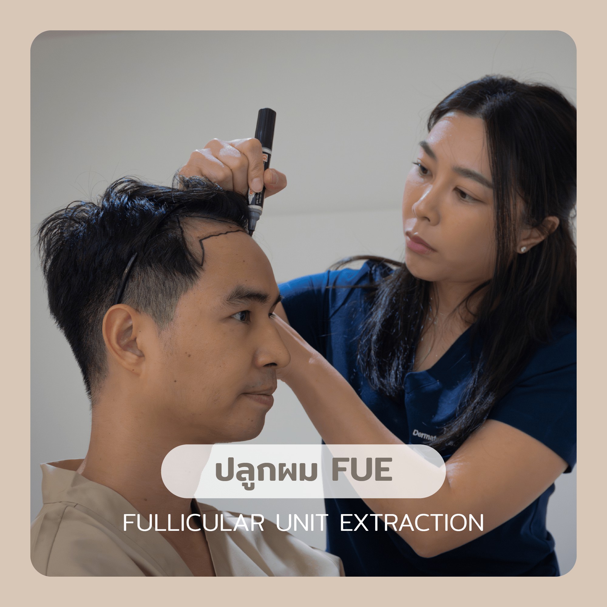 FUE Hair Transplant