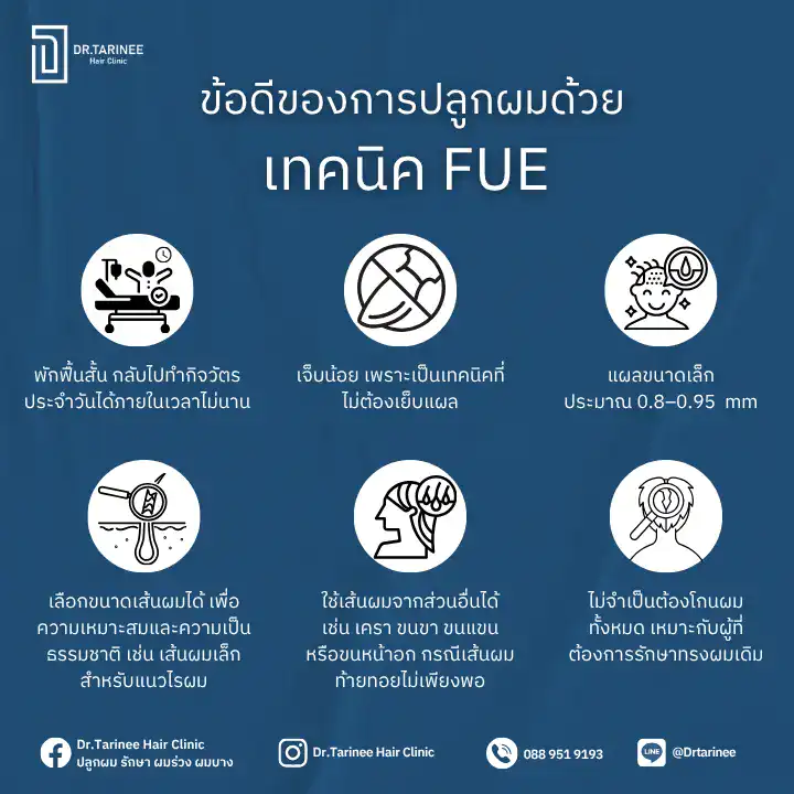 FUE ปลูกผม