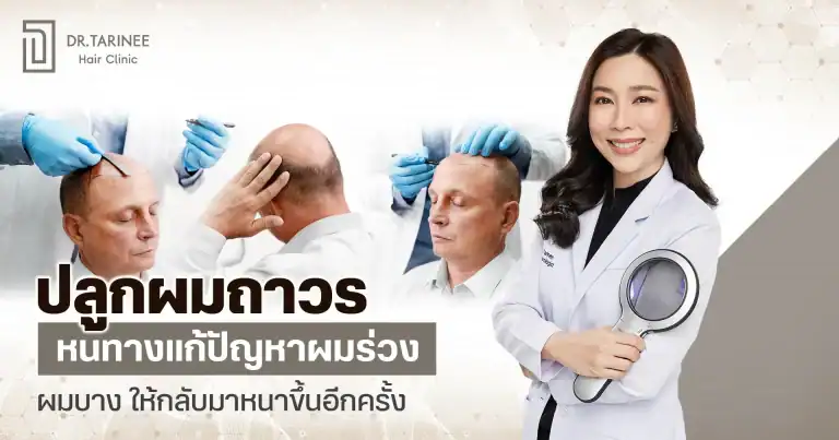 ปลูกผมถาวร หนทางแก้ปัญหาผมร่วง ผมบาง ให้กลับมาหนาขึ้นอีกครั้ง