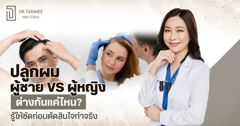 ปลูกผม ผู้ชาย VS ผู้หญิง ต่างกันแค่ไหน? รู้ให้ชัดก่อนตัดสินใจทำจริง